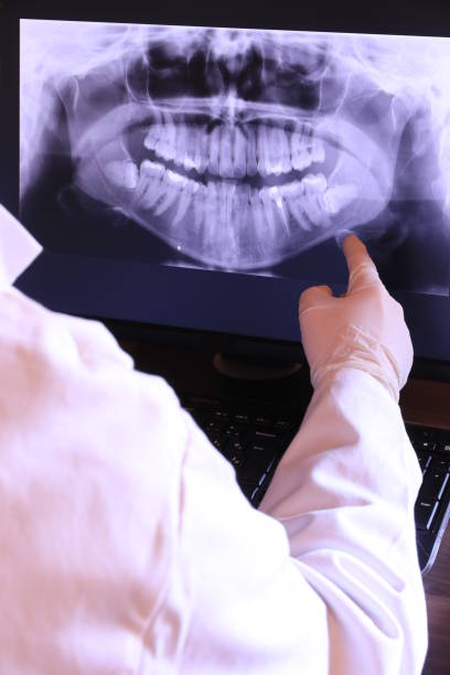 Best Emergency Treatment for Dental Infections or Abscesses in Brush Prairie, WA