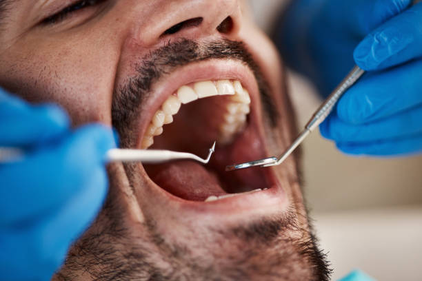 Best Weekend Emergency Dentist in Brush Prairie, WA